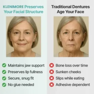 KLENIMORE™ Medical Full Denture with Strong Suction