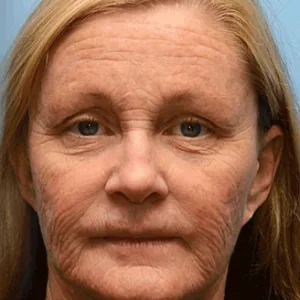 👏🌿 Made in the USA  direct shipping 💫KLENIMORE™ Botox Vitamin A Retinol Anti-Wrinkle Firming and Lifting Cream — Last Day for Limited Time 70% OFF