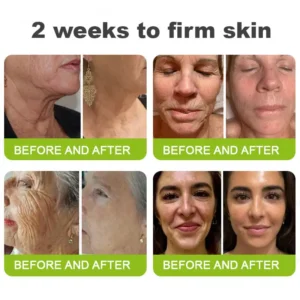 👏🌿 Made in the USA  direct shipping 💫KLENIMORE™ Botox Vitamin A Retinol Anti-Wrinkle Firming and Lifting Cream — Last Day for Limited Time 70% OFF