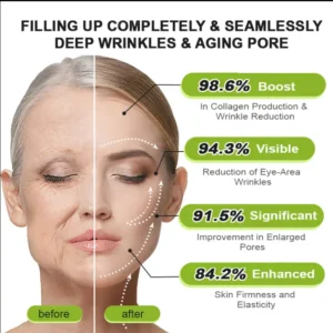 👏🌿 Made in the USA  direct shipping 💫KLENIMORE™ Botox Vitamin A Retinol Anti-Wrinkle Firming and Lifting Cream — Last Day for Limited Time 70% OFF