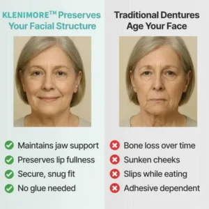 🌎Ends Today: 60% OFF! ⏰KLENIMORE™ Medical Full Denture with Strong Suction