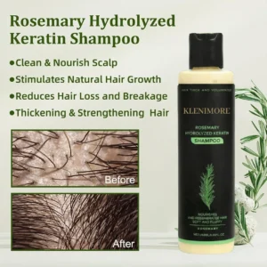 ⭐Get beautiful hair in a week-KLENIMORE™ Rosemary Hydrolyzed Keratin Shampoo🎁