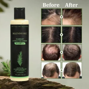 ⭐Get beautiful hair in a week-KLENIMORE™ Rosemary Hydrolyzed Keratin Shampoo🎁
