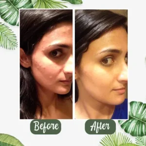 KLENIMORE™ 100% Natural Green Tea Deep Cleanse Mask