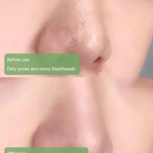 KLENIMORE™ 100% Natural Green Tea Deep Cleanse Mask