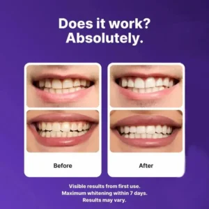 👨‍⚕️KLENIMORE™ Purple Teeth Whitening Strips:Revolutionary Dissolving Diamond Series Technology with Hydroxyapatite 💎