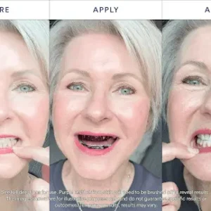 👨‍⚕️KLENIMORE™ Purple Teeth Whitening Strips:Revolutionary Dissolving Diamond Series Technology with Hydroxyapatite 💎