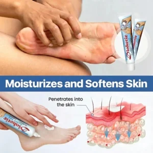 🌟2026 Top-Selling Items | Limited-Time 50% Off Sale🔥KLENIMORE™ VitaGluco Diabetes Treatment Cream🚨Low Stock