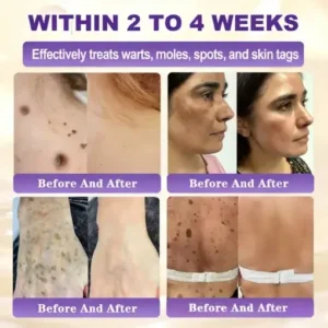 KLENIMORE™ Biotin 10-in-1 Skin Restoration Cream