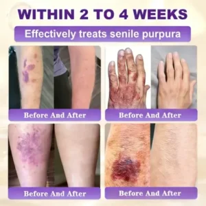 KLENIMORE™ Biotin 10-in-1 Skin Restoration Cream