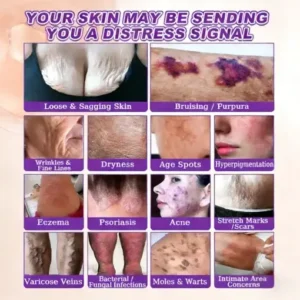 KLENIMORE™ Biotin 10-in-1 Skin Restoration Cream