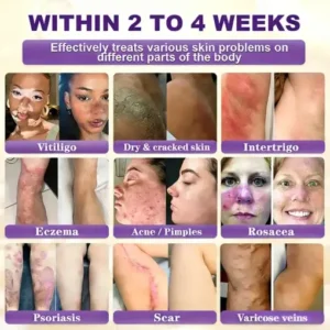 KLENIMORE™ Biotin 10-in-1 Skin Restoration Cream