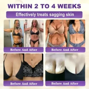 KLENIMORE™ Biotin 10-in-1 Skin Restoration Cream