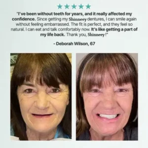 KLENIMORE™ Custom Fit for a Fresh Smile, Say Goodbye to Wearing Discomfort!