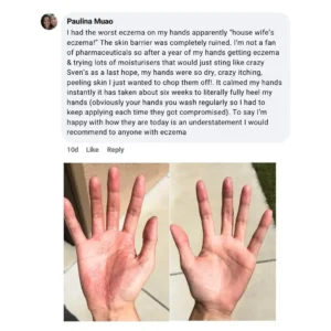 KLENIMORE Daily Defence Cream for Dry, Itchy Skin – 250g