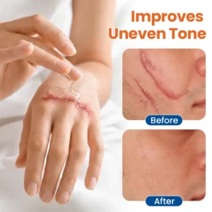 KLENIMORE™ DermalRebuild Skin Renewal Gel