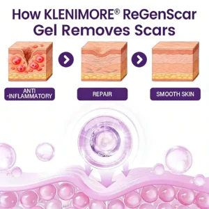 KLENIMORE® ReGenScar Stem Cell Scar Gel