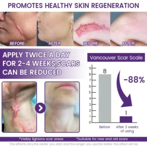 KLENIMORE® ReGenScar Stem Cell Scar Gel