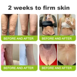 👏🌿Made and shipped from the USA 💫KLENIMORE™ Botox & Vita-A Retinol Shot Wrinkle-Lift Tightening cream - Last Day Promotion 70% OFF