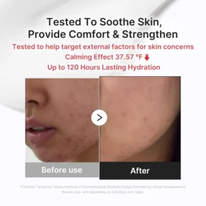 KLENIMORE 3H Daily Relief Cream - Guaiazulene & Centella Soothing Moisturizer for Sensitive Skin