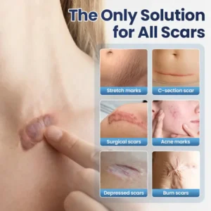 KLENIMORE™ Texture Repair Gel – Instantly Smooth, Repair & Revive Damaged Surfaces