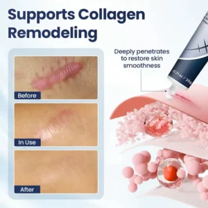 KLENIMORE™ Texture Repair Gel – Instantly Smooth, Repair & Revive Damaged Surfaces