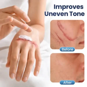 KLENIMORE™ Texture Repair Gel – Instantly Smooth, Repair & Revive Damaged Surfaces