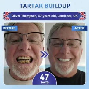 KLENIMORE® Tideglusib Fast‑Dissolving Tooth & Gum Repair Oral Strips