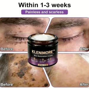 Made and Shipped from USA ✨KLENIMORE™ Biotin 10-in-1 Skin Restoration Cream 🍀