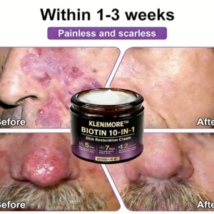 Made and Shipped from USA ✨KLENIMORE™ Biotin 10-in-1 Skin Restoration Cream 🍀