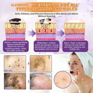 Made and Shipped from USA ✨KLENIMORE™ Biotin 10-in-1 Skin Restoration Cream 🍀