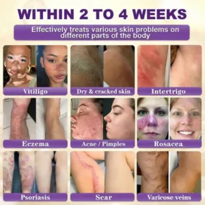 Made and Shipped from USA ✨KLENIMORE™ Biotin 10-in-1 Skin Restoration Cream 🍀