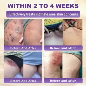 Made and Shipped from USA ✨KLENIMORE™ Biotin 10-in-1 Skin Restoration Cream 🍀