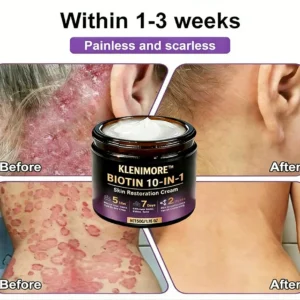 Made and Shipped from USA ✨KLENIMORE™ Biotin 10-in-1 Skin Restoration Cream 🍀