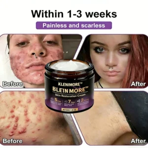 Made and Shipped from USA ✨KLENIMORE™ Biotin 10-in-1 Skin Restoration Cream 🍀