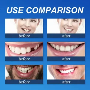 ⏰ Ends Today: 70% OFF! KLENIMORE™ Natural Smile Upgrade