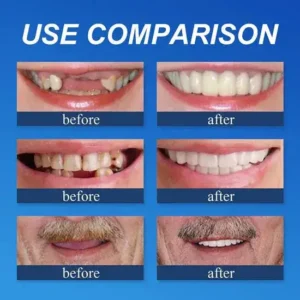 ⏰Ends Today: 70% OFF! 🌎KLENIMORE™ Custom-Fit Dentures— Designed for Comfort and a Natural-Looking Smile