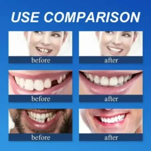 KLENIMORE™ Premium Denture 2026 | Custom-Fit Dentures