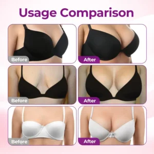 KLENIMORE™ Targeted Breast Enhancement Advanced Nano Microneedle Patch