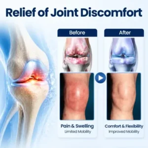 KLENIMORE® ArthriNAD+ Pro Advanced Joint Recovery Cream