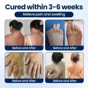 KLENIMORE® ArthriNAD+ Pro Advanced Joint Recovery Cream