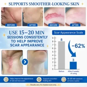 KLENIMORE™ Laser Scar Care Pen