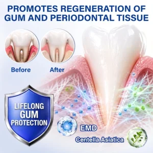 KLENIMORE™ 🦷
  
  periodontal repair gel