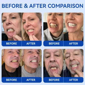 KLENIMORE™ 🦷
  
  periodontal repair gel