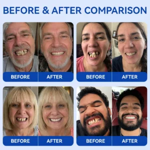 KLENIMORE™ 🦷
  
  periodontal repair gel