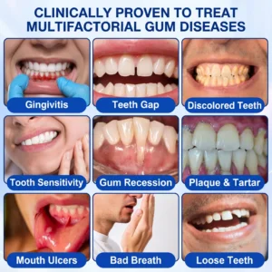 KLENIMORE™ 🦷
  
  periodontal repair gel