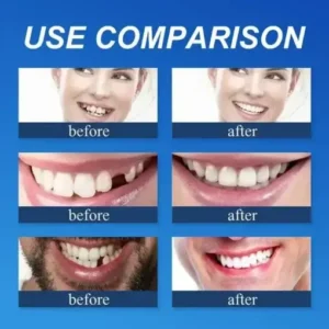 KLENIMORE™ Medical Grade, Strong Adhesion, Custom Fit
